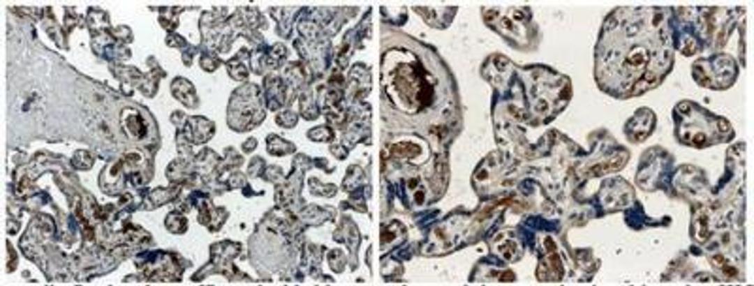 Immunohistochemistry-Paraffin: Angiopoietin-1 Antibody (MM0019-26B10) [NB110-85464] - Angiopoietin 1 Antibody (MM0019-26B10) [NB110-85464] - Formalin fixed and paraffin embedded human placental tissue section is subjected to IHC with anti human Angiopoietin-1.