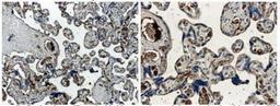 Immunohistochemistry-Paraffin: Angiopoietin-1 Antibody (MM0019-26B10) [NB110-85464] - Angiopoietin 1 Antibody (MM0019-26B10) [NB110-85464] - Formalin fixed and paraffin embedded human placental tissue section is subjected to IHC with anti human Angiopoietin-1.