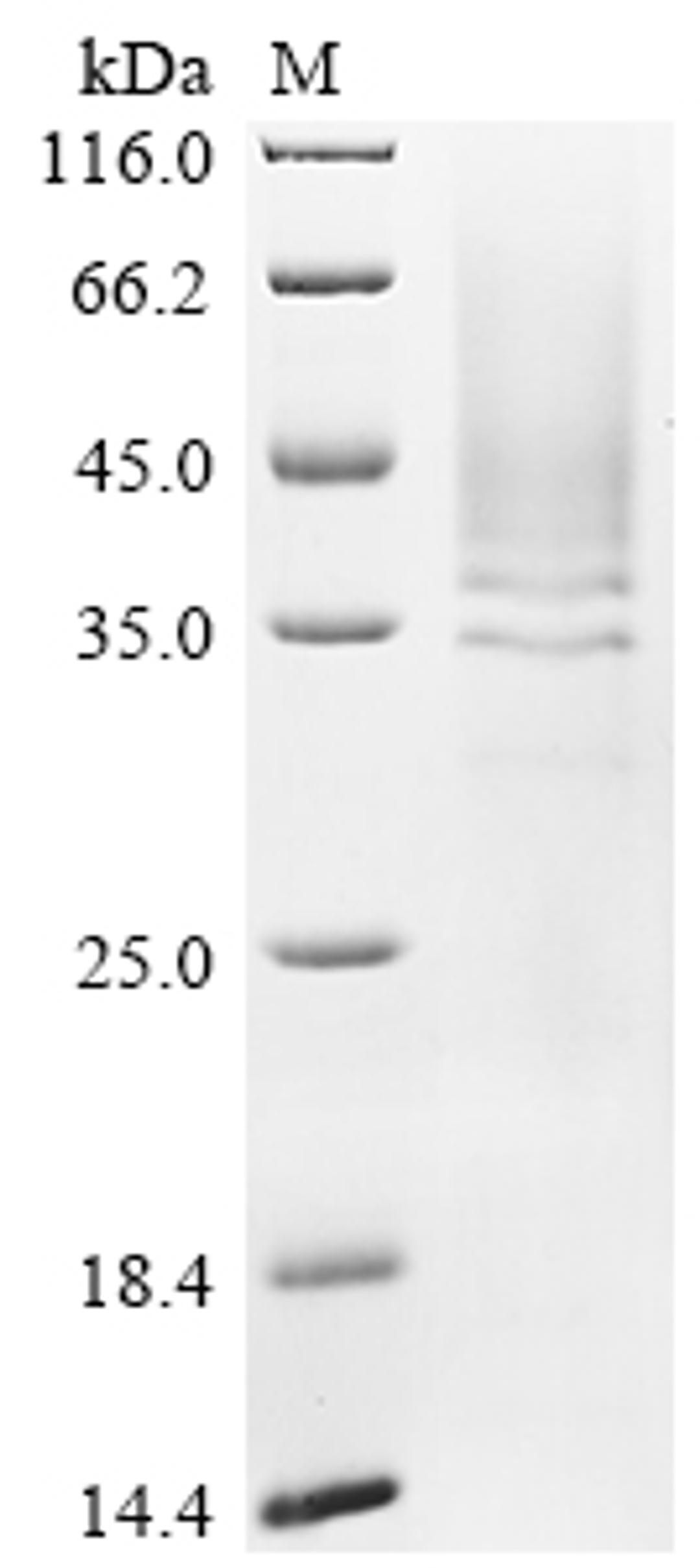 (Tris-Glycine gel) Discontinuous SDS-PAGE (reduced) with 5% enrichment gel and 15% separation gel.