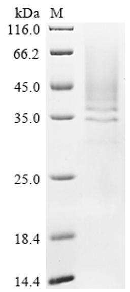 (Tris-Glycine gel) Discontinuous SDS-PAGE (reduced) with 5% enrichment gel and 15% separation gel.