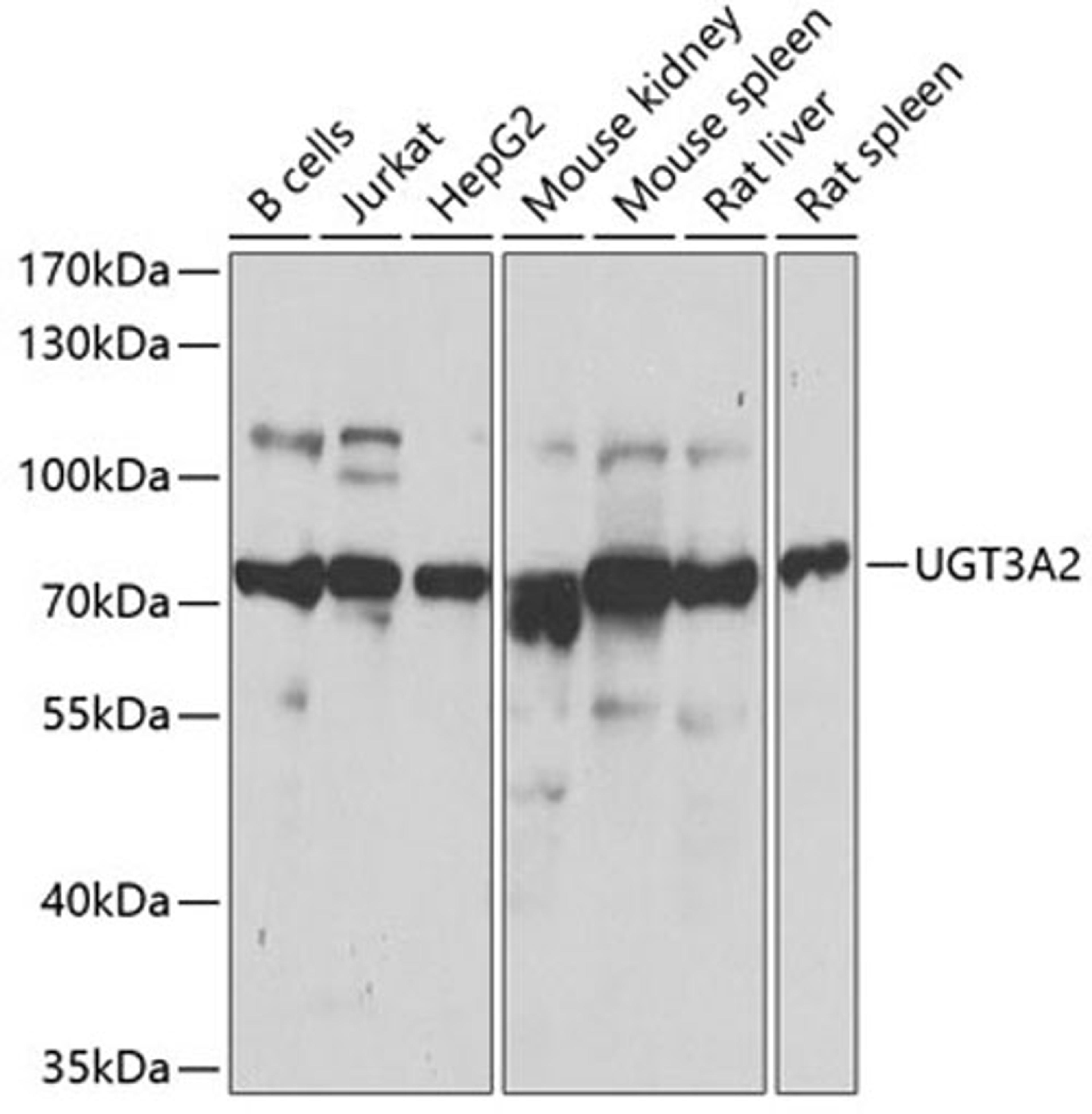 Western blot - UGT3A2 antibody (A7611)