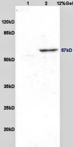 Western blot analysis of rat brain lysates (Lane1), rat brain lysates (Lane2) dilution at:1:200 using Anti-Pancreatic Amylase antibody