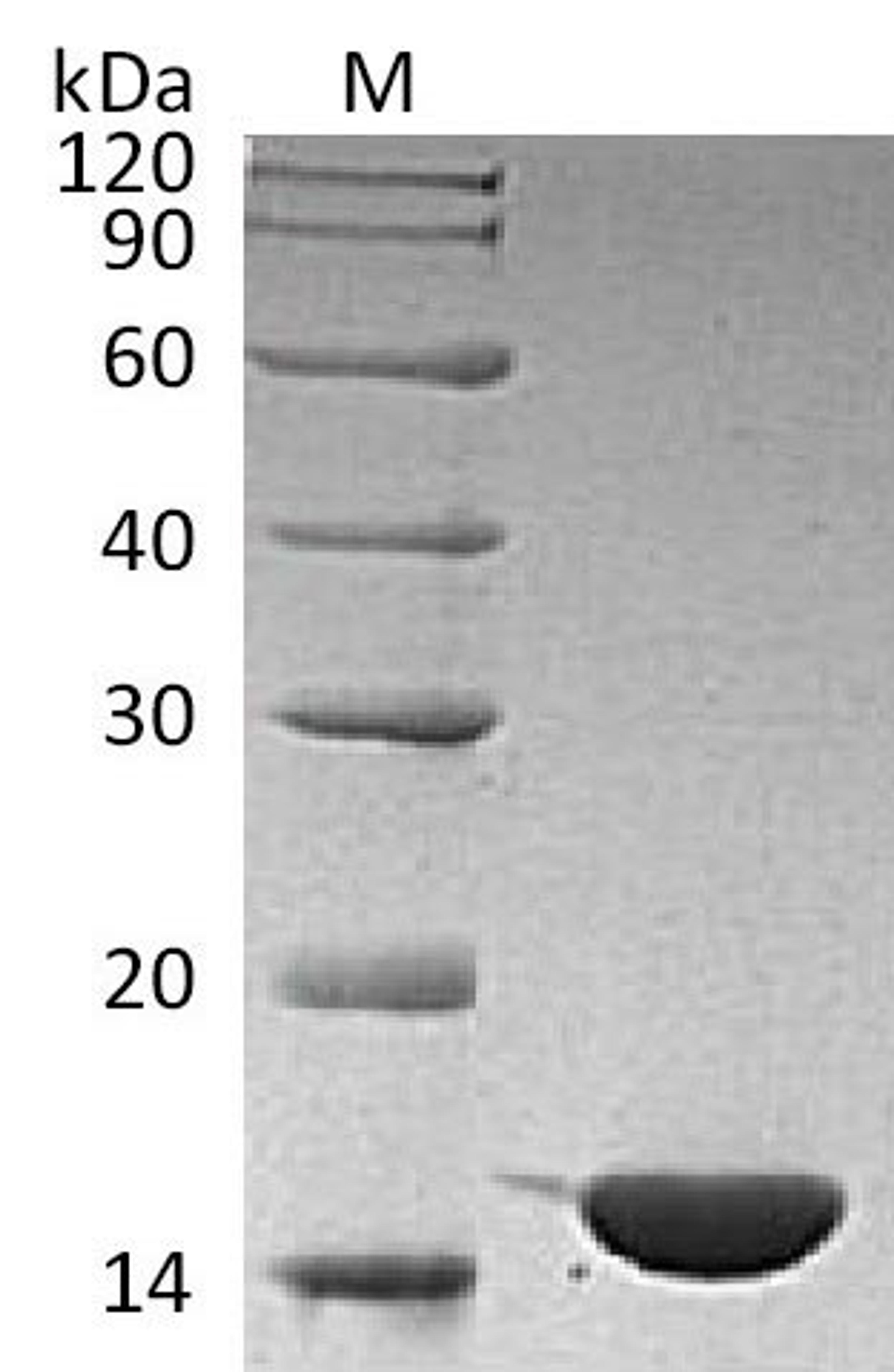 (Tris-Glycine gel) Discontinuous SDS-PAGE (reduced) with 5% enrichment gel and 15% separation gel.