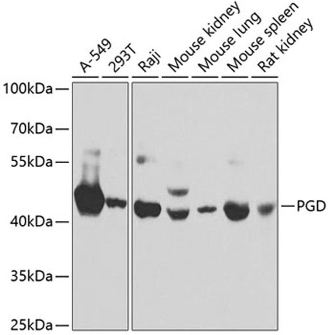 Western blot - PGD antibody (A7710)