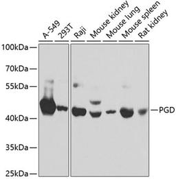 Western blot - PGD antibody (A7710)