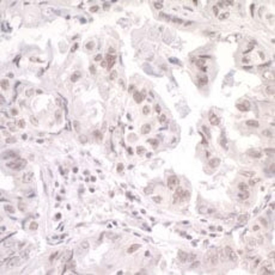 Detection of human SKIV2L2 by immunohistochemistry.