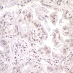 Detection of human SKIV2L2 by immunohistochemistry.