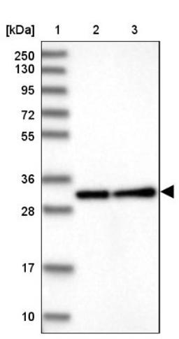 Western Blot: FGD4 Antibody [NBP1-85532] - Lane 1: Marker [kDa] 250, 130, 95, 72, 55, 36, 28, 17, 10<br/>Lane 2: Human cell line RT-4<br/>Lane 3: Human cell line U-251MG sp