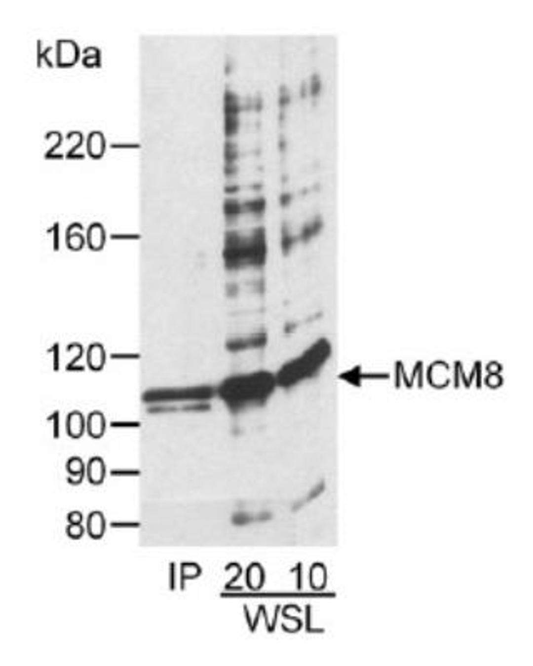 Western Blot: MCM8 Antibody [NB100-325] - and Immunoprecipitation. Samples: Whole cell lysate (10 or 20 ug) from HeLa cells or MCM8 immunoprecipitated from whole cell  lysate (1 mg). Antibody: Affinity purified goat anti-MCM8 used at 1 ug/ml for Western Blot or 2ug/mg lysate for IP. Detection: Chemiluminescence with 5 min exposure.