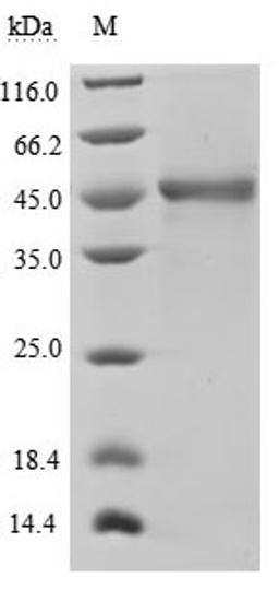 (Tris-Glycine gel) Discontinuous SDS-PAGE (reduced) with 5% enrichment gel and 15% separation gel.