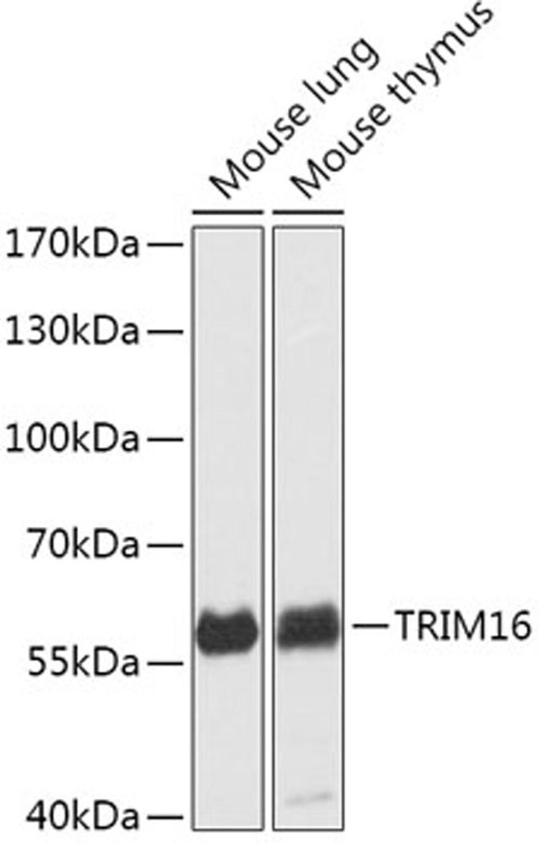 Western blot - TRIM16 antibody (A17619)