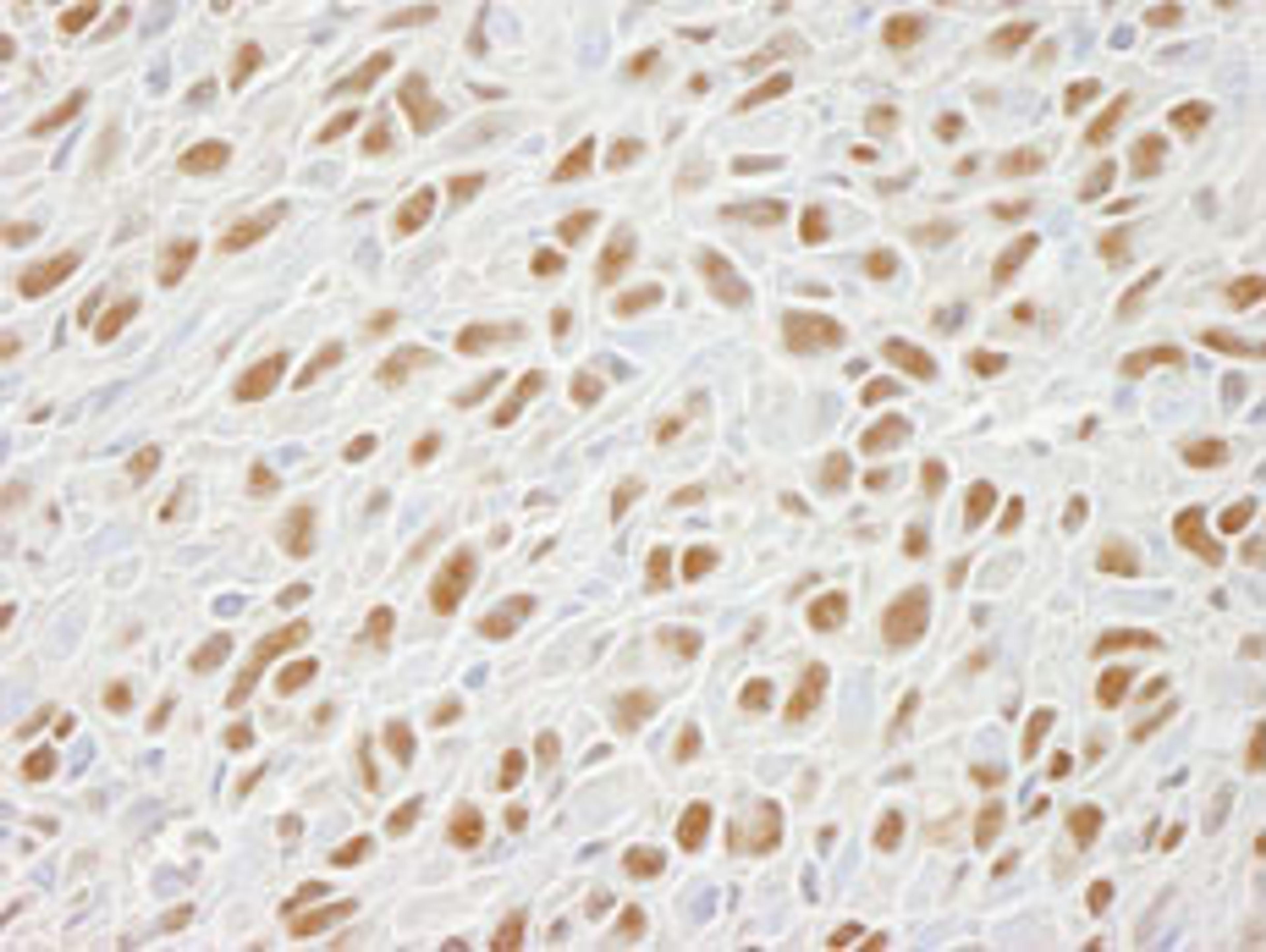 Detection of mouse SMC1 by immunohistochemistry.