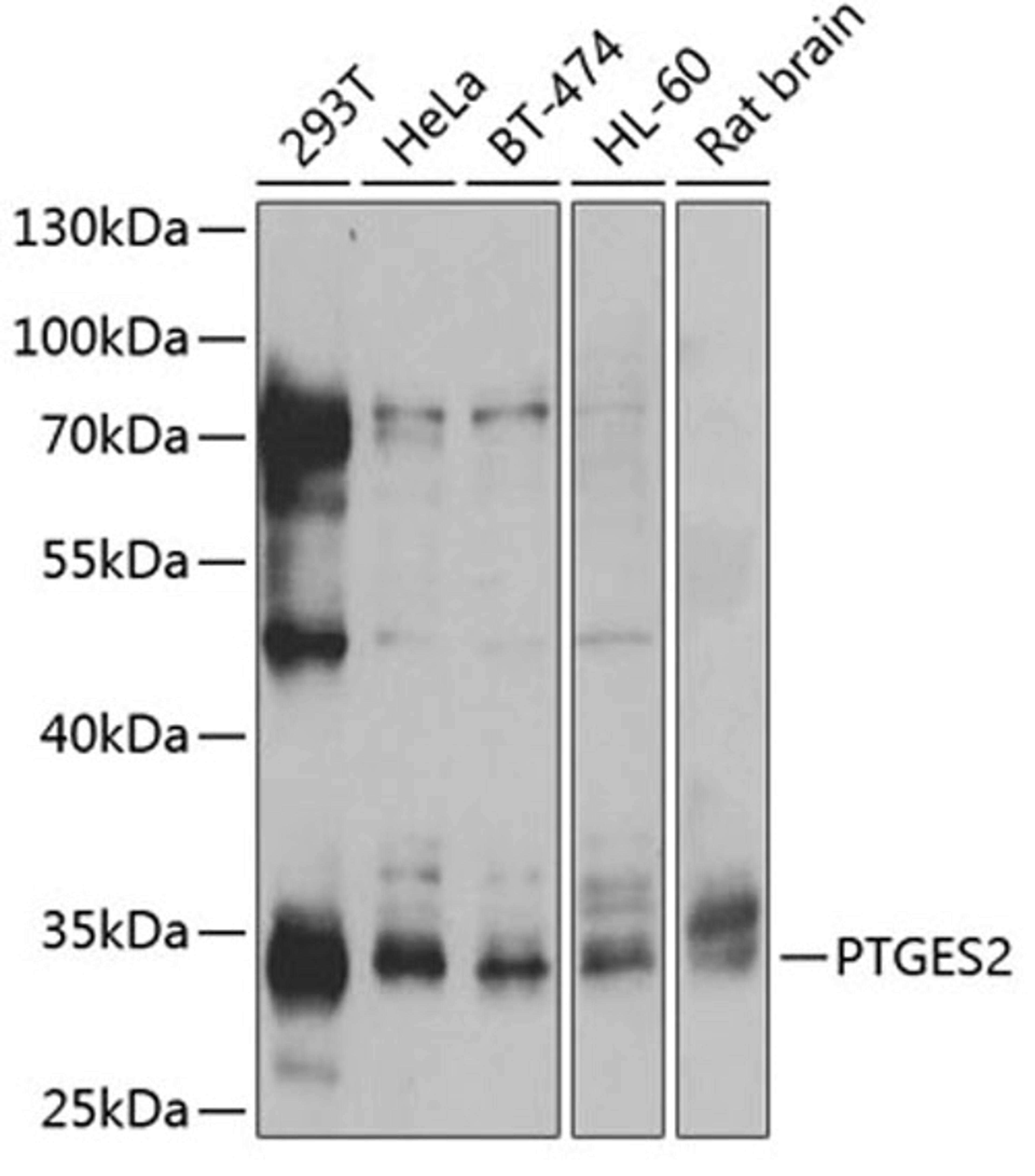 Western blot - PTGES2 antibody (A13440)