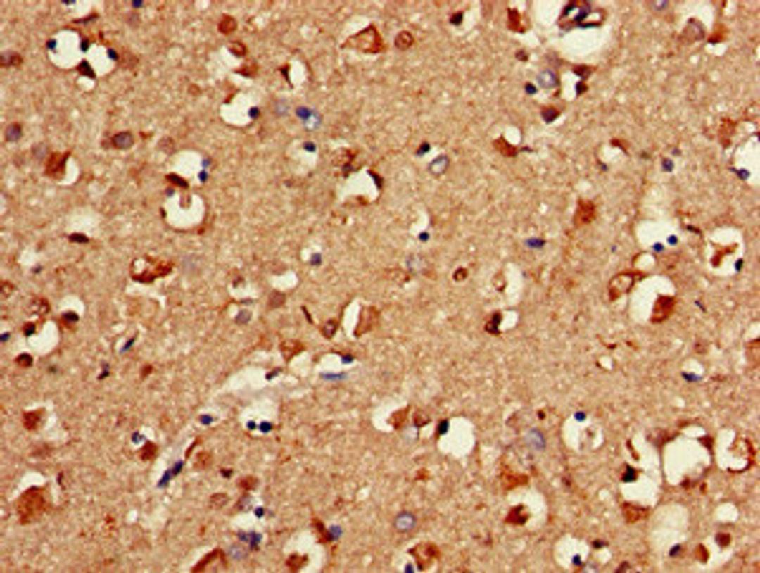 Immunohistochemistry of paraffin-embedded human brain tissue using CSB-PA007938LA01HU at dilution of 1:100