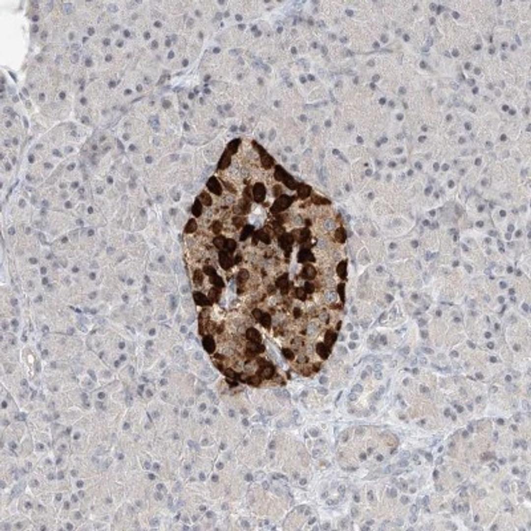 Immunohistochemistry-Paraffin: KLHL22 Antibody [NBP1-82238] - Staining of human pancreas shows strong cytoplasmic positivity in subsets of islet cells.