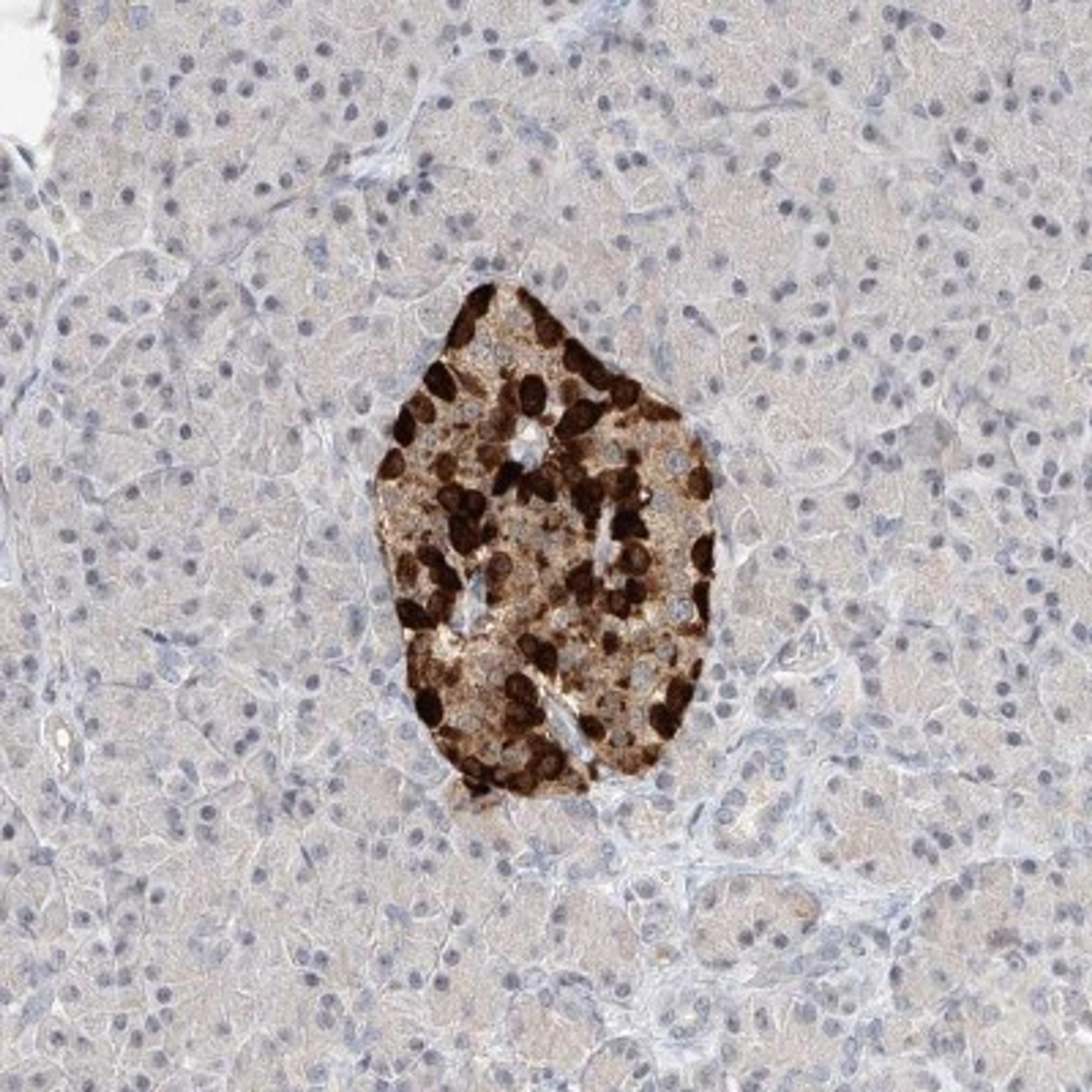 Immunohistochemistry-Paraffin: KLHL22 Antibody [NBP1-82238] - Staining of human pancreas shows strong cytoplasmic positivity in subsets of islet cells.