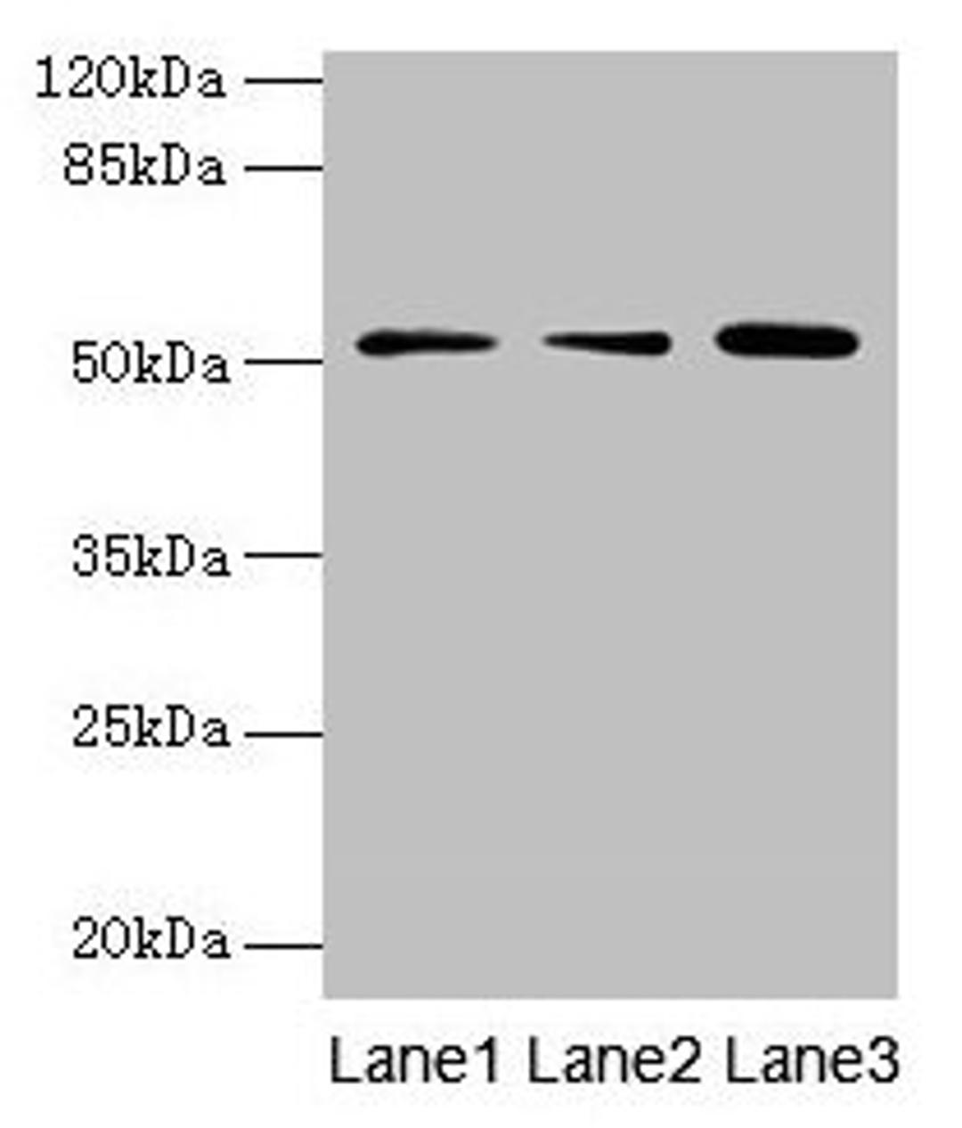 Western blot. All lanes: ACSBG2 antibody at 4µg/ml. Lane 1: A431 whole cell lysate. Lane 2: K562 whole cell lysate. Lane 3: A549 whole cell lysate. Secondary. Goat polyclonal to rabbit IgG at 1/10000 dilution. Predicted band size: 75, 69, 54, 52 kDa. Observed band size: 52 kDa