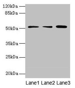 Western blot. All lanes: ACSBG2 antibody at 4µg/ml. Lane 1: A431 whole cell lysate. Lane 2: K562 whole cell lysate. Lane 3: A549 whole cell lysate. Secondary. Goat polyclonal to rabbit IgG at 1/10000 dilution. Predicted band size: 75, 69, 54, 52 kDa. Observed band size: 52 kDa