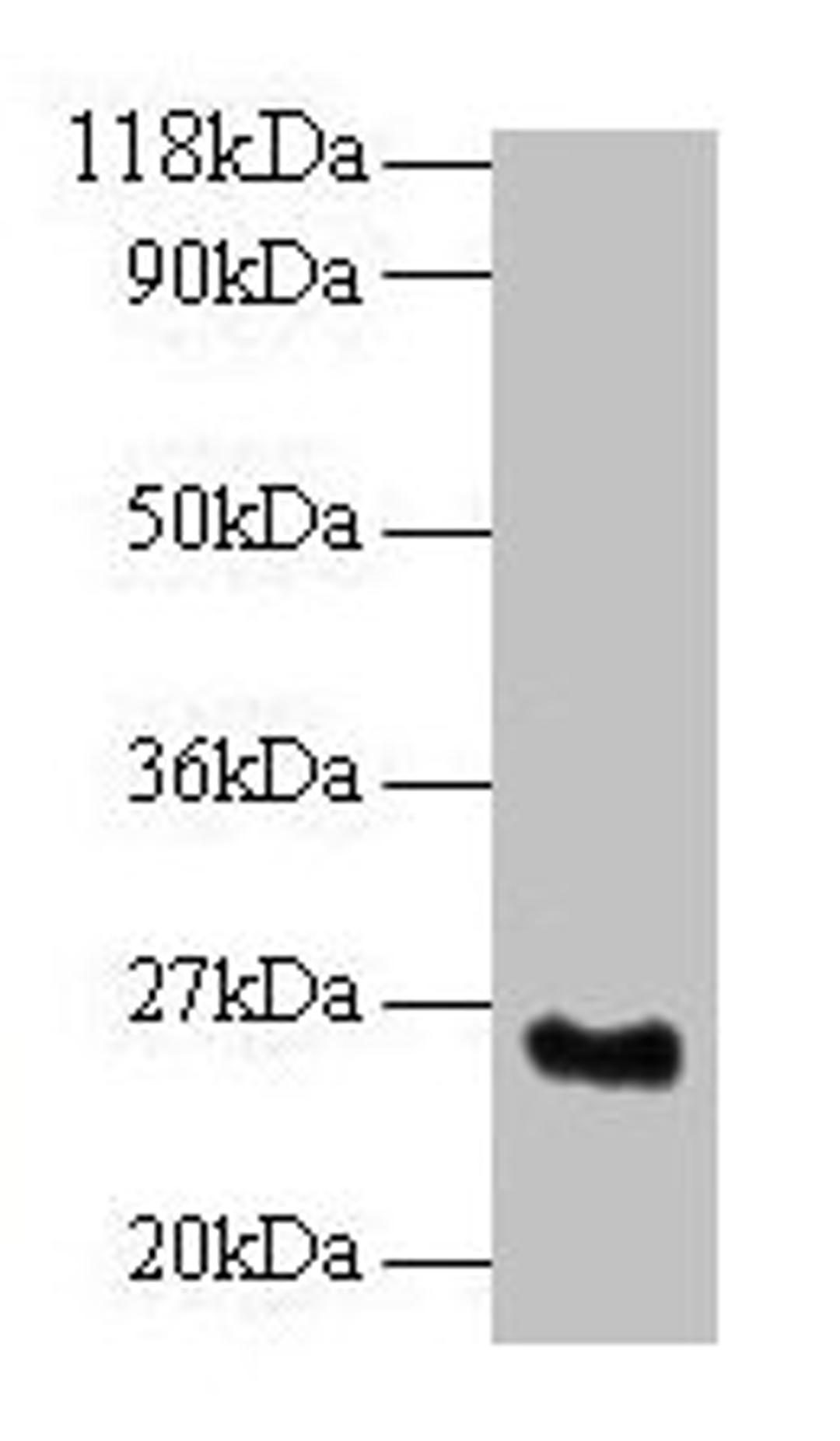 Western blot. All lanes: SRSF9 antibody at 2µg/ml + Mouse kidney tissue. Secondary. Goat polyclonal to rabbit IgG at 1/10000 dilution. Predicted band size: 26 kDa. Observed band size: 26 kDa