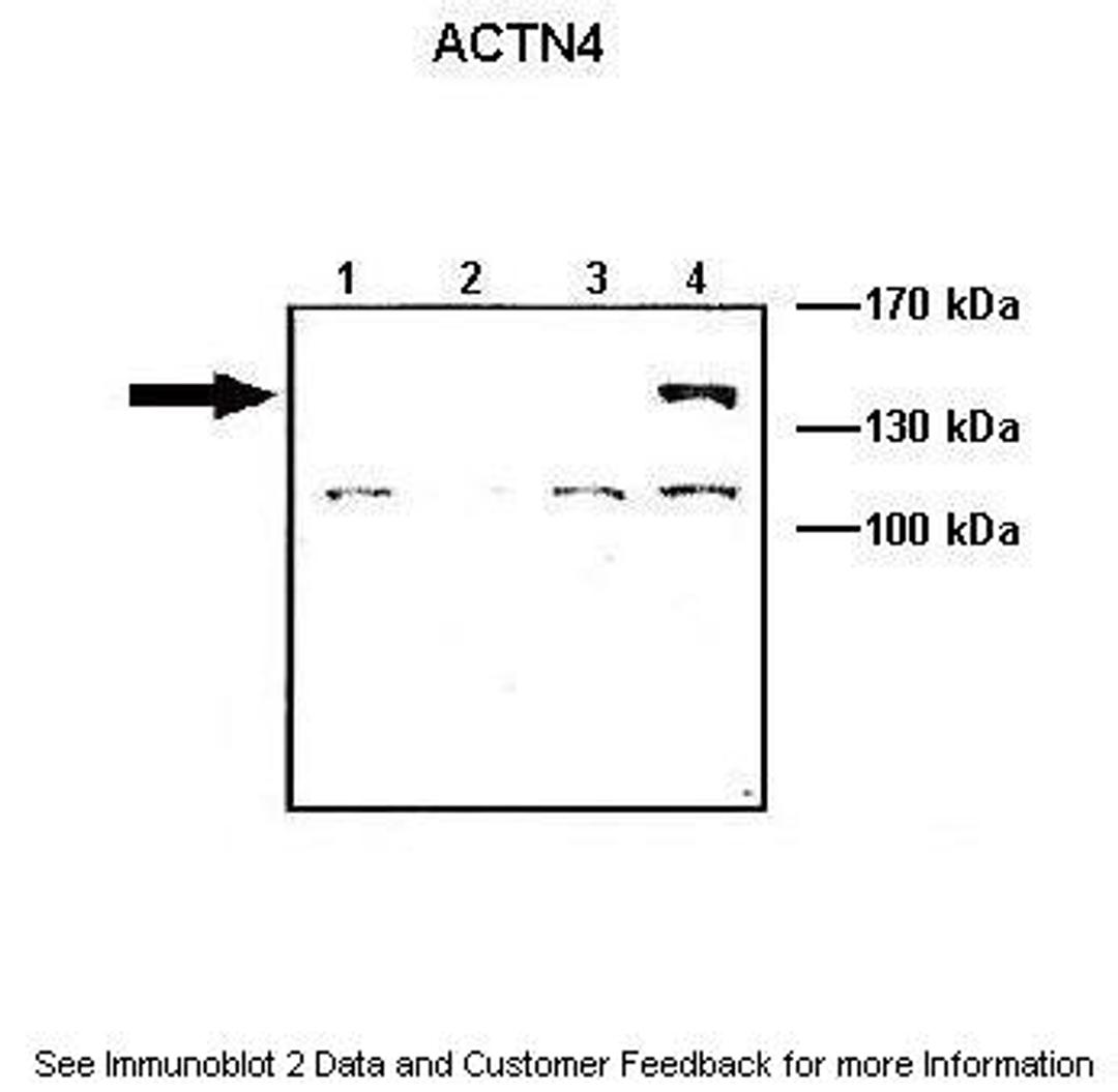 Antibody used in WB on ACTNX-GFP transfected at: 1:1000 (Lane1: 10 ug ACTN1-GFP transfected COS-7 lysate, Lane2: 10 ug ACTN2-GFP transfected COS-7 lysate, Lane3: 10 ug ACTN3-GFP transfected COS-7 lysate, Lane4: 10 ug ACTN4-GFP transfected COS-7 lysate).