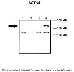 Antibody used in WB on ACTNX-GFP transfected at: 1:1000 (Lane1: 10 ug ACTN1-GFP transfected COS-7 lysate, Lane2: 10 ug ACTN2-GFP transfected COS-7 lysate, Lane3: 10 ug ACTN3-GFP transfected COS-7 lysate, Lane4: 10 ug ACTN4-GFP transfected COS-7 lysate).