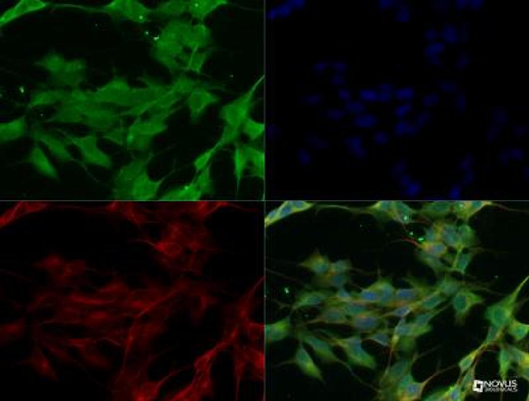 Immunocytochemistry/Immunofluorescence: SARM1 Antibody [NBP2-29625] - SARM1 antibody was tested in SHSY5Y cells with DyLight 488 (green). Nuclei and alpha-tubulin were counterstained with DAPI (blue) and Dylight 550 (red).