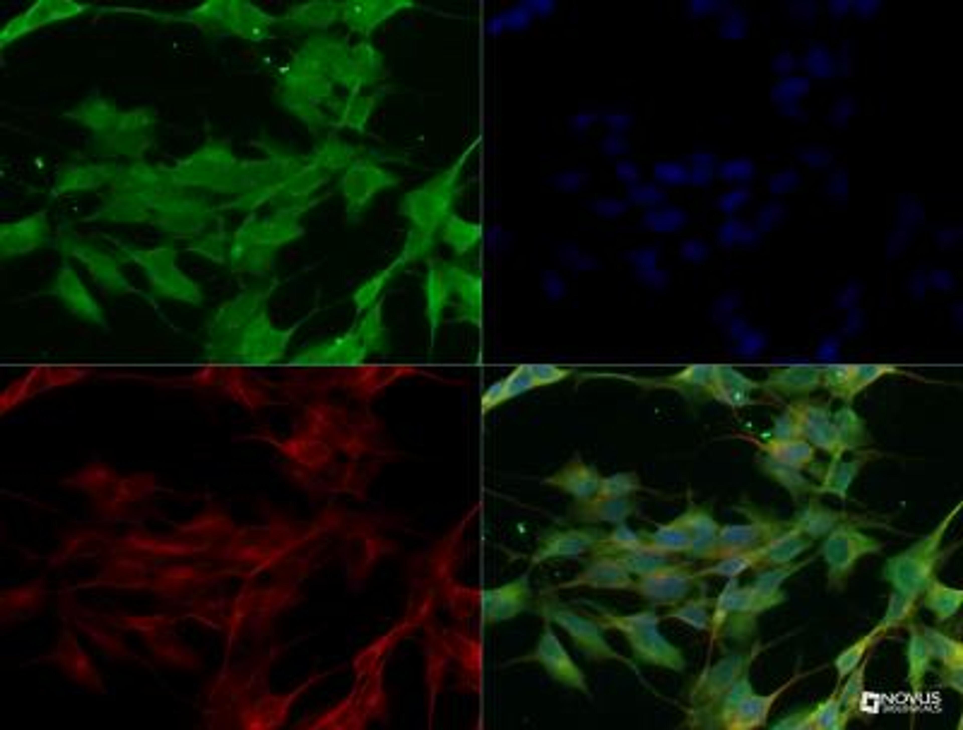 Immunocytochemistry/Immunofluorescence: SARM1 Antibody [NBP2-29625] - SARM1 antibody was tested in SHSY5Y cells with DyLight 488 (green). Nuclei and alpha-tubulin were counterstained with DAPI (blue) and Dylight 550 (red).