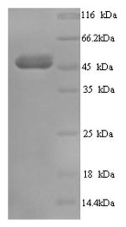 (Tris-Glycine gel) Discontinuous SDS-PAGE (reduced) with 5% enrichment gel and 15% separation gel.