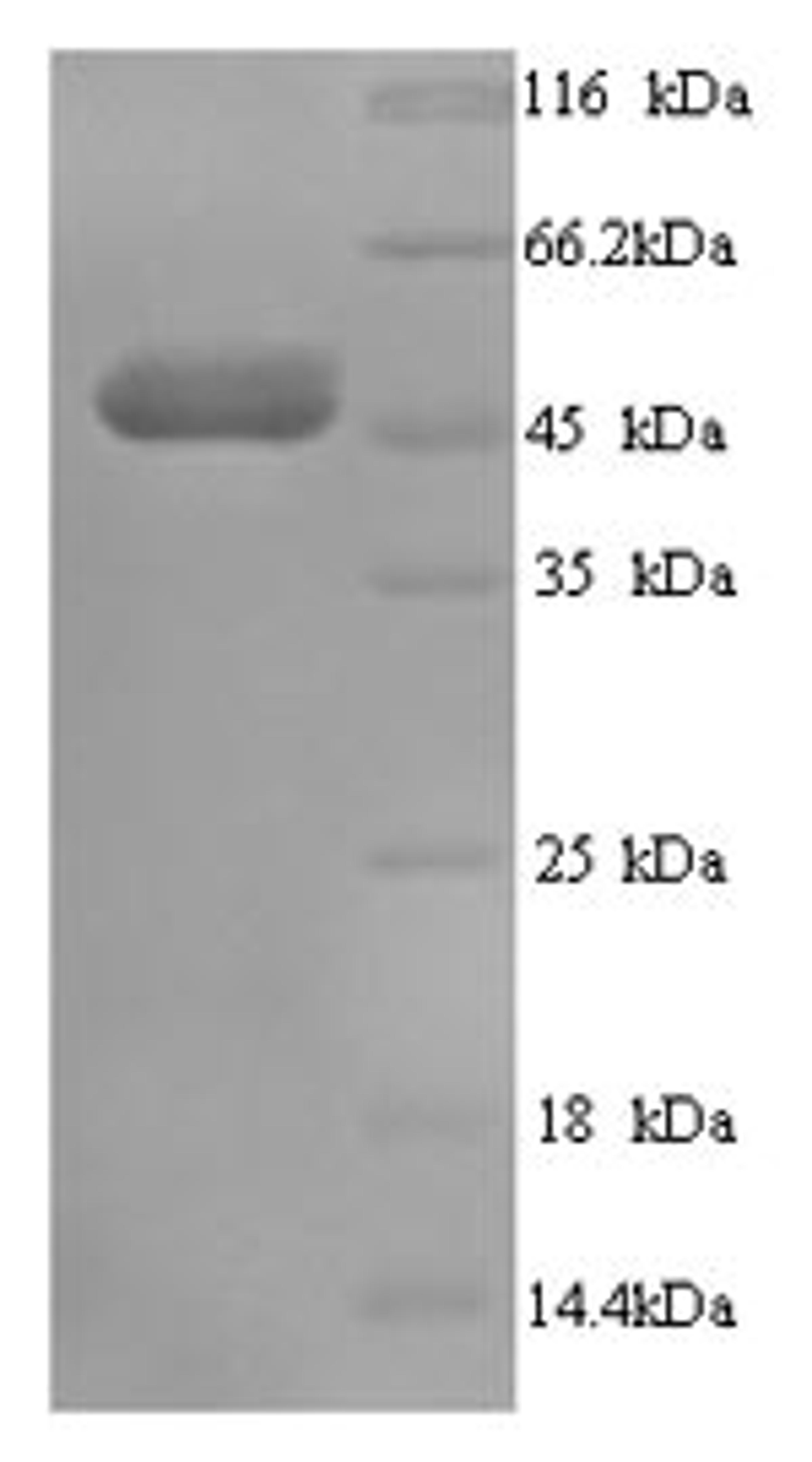 (Tris-Glycine gel) Discontinuous SDS-PAGE (reduced) with 5% enrichment gel and 15% separation gel.