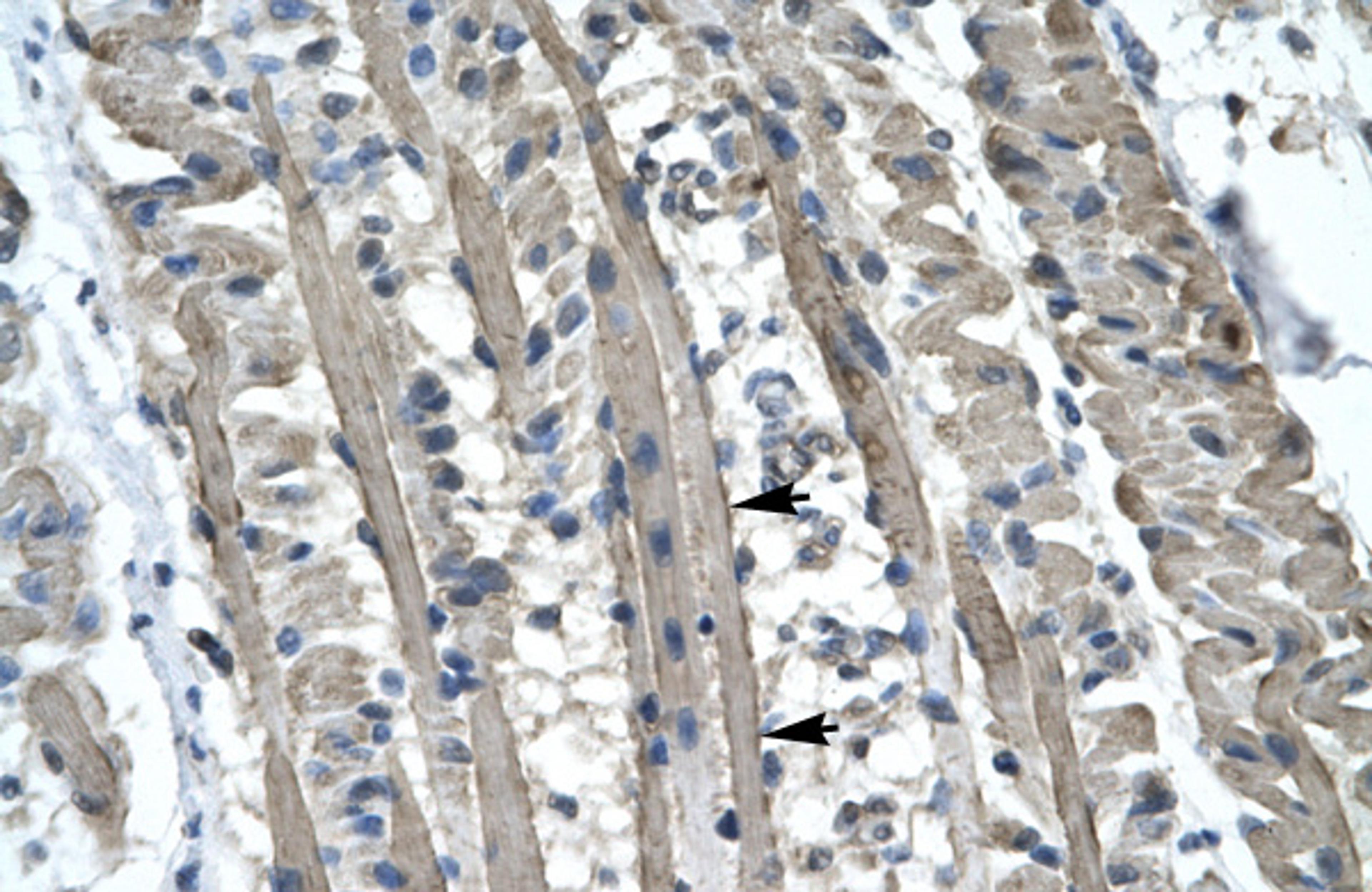 Antibody used in IHC on Human Muscle.