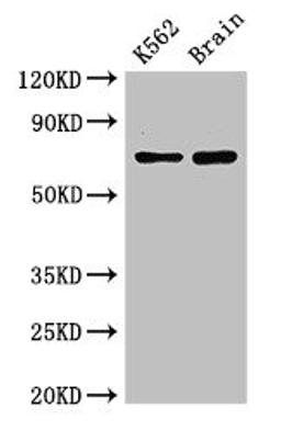 Western Blot. Positive WB detected in: K562 whole cell lysate, Mouse brain tissue. All lanes: SLU7 antibody at 3ug/ml. Secondary. Goat polyclonal to rabbit IgG at 1/50000 dilution. Predicted band size: 69 kDa. Observed band size: 69 kDa. 