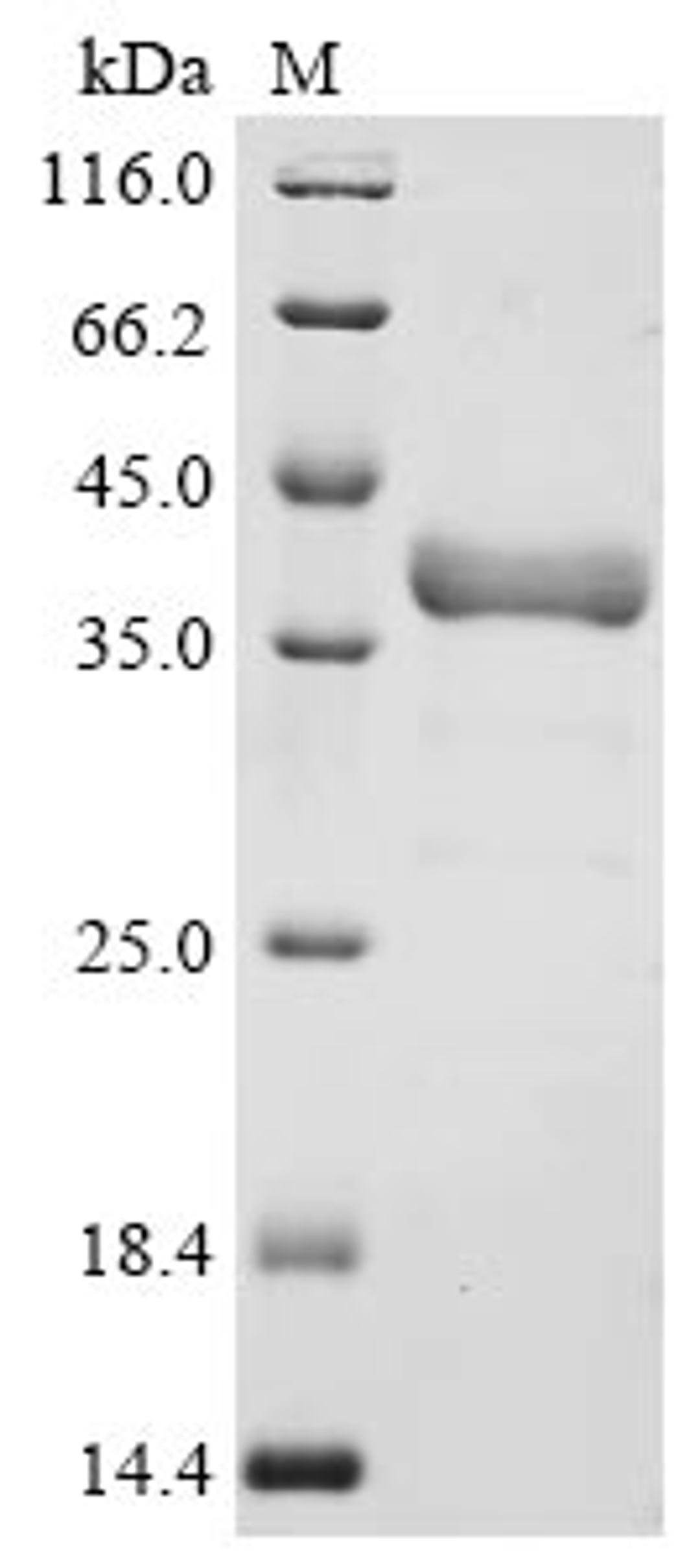 (Tris-Glycine gel) Discontinuous SDS-PAGE (reduced) with 5% enrichment gel and 15% separation gel.