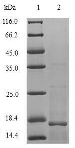 (Tris-Glycine gel) Discontinuous SDS-PAGE (reduced) with 5% enrichment gel and 15% separation gel.