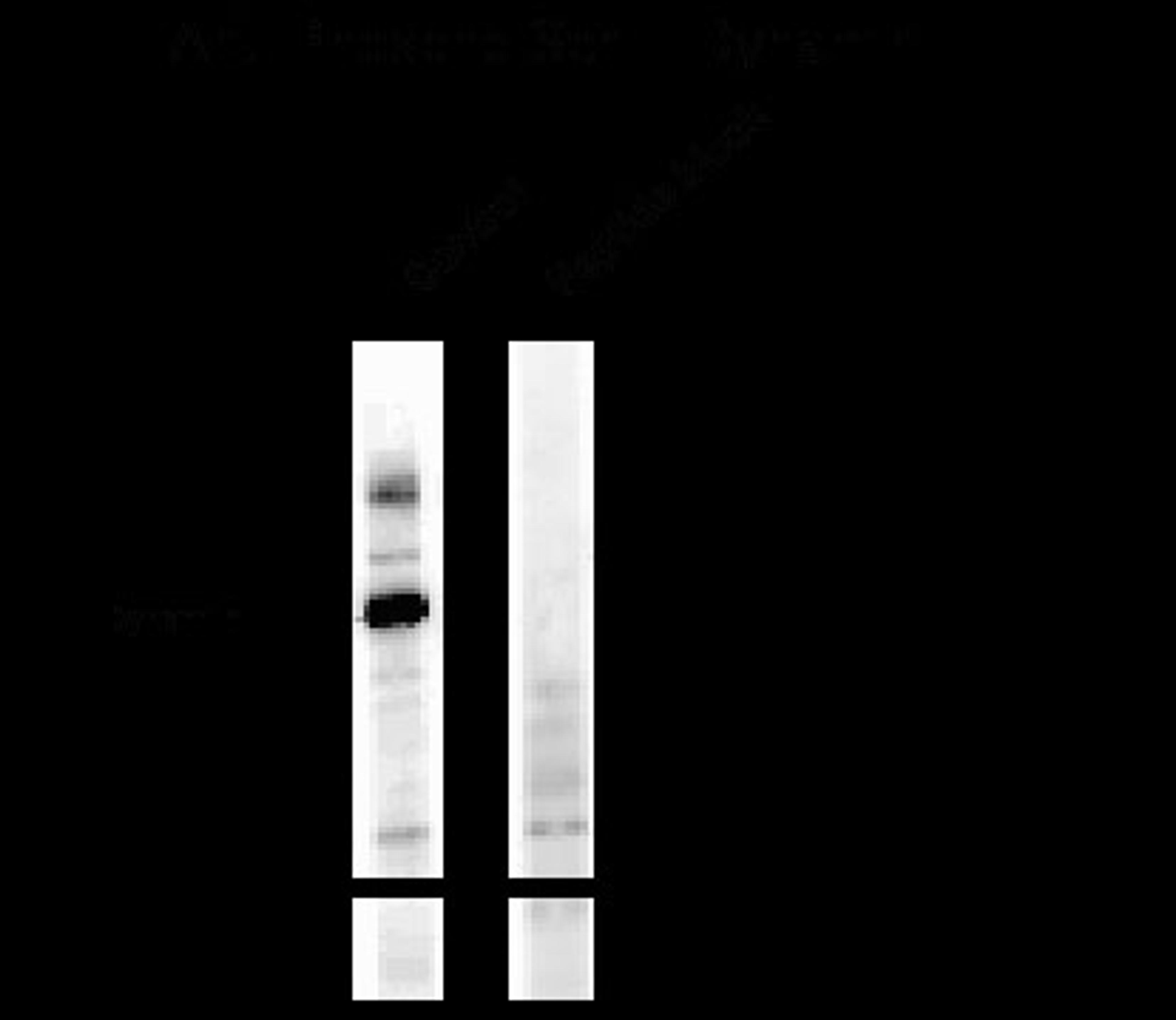 Western blot of a forskolin stimulated rat hippocampal lysate showing phospho-specific immunolabeling of the ~95k Dynamin protein phosphorylated at Ser774.