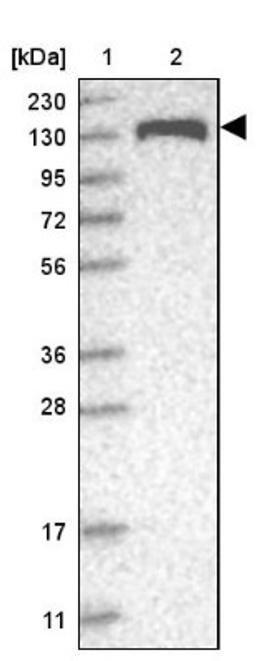 Western Blot: AZ1 Antibody [NBP1-90053] - Lane 1: Marker [kDa] 230, 130, 95, 72, 56, 36, 28, 17, 11<br/>Lane 2: Human cell line RT-4