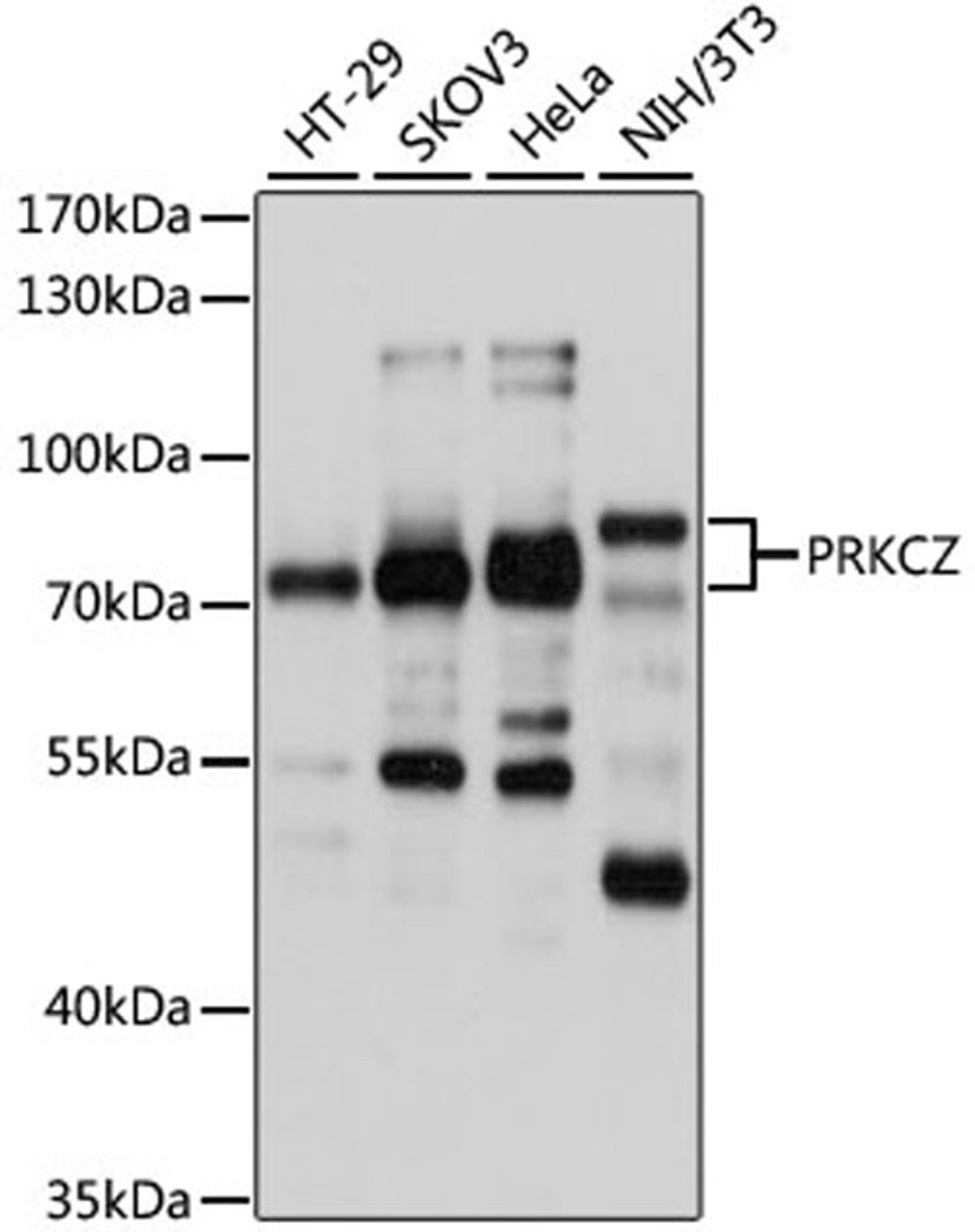 Western blot - PRKCZ antibody (A5714)