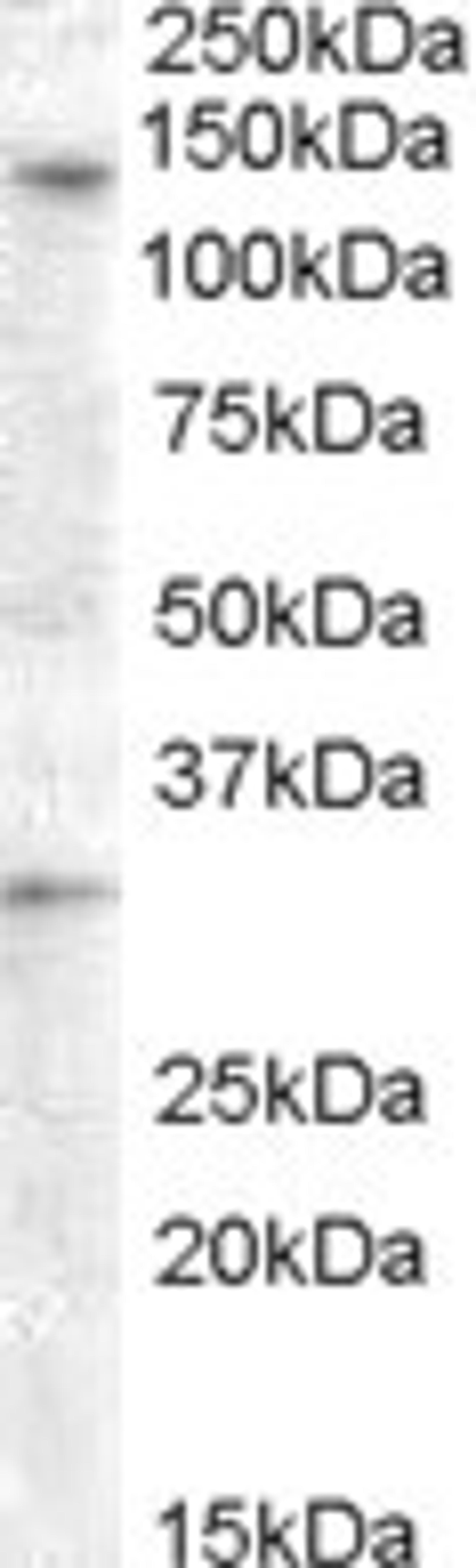 Western Blot: GPR125 Antibody [NBP1-03561] - (0.5ug/ml) staining of Human Ovary lysate (35ug protein in RIPA buffer). Primary incubation was 1 hour. Detected by chemiluminescence.