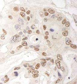 Detection of human QSER1 by immunohistochemistry.