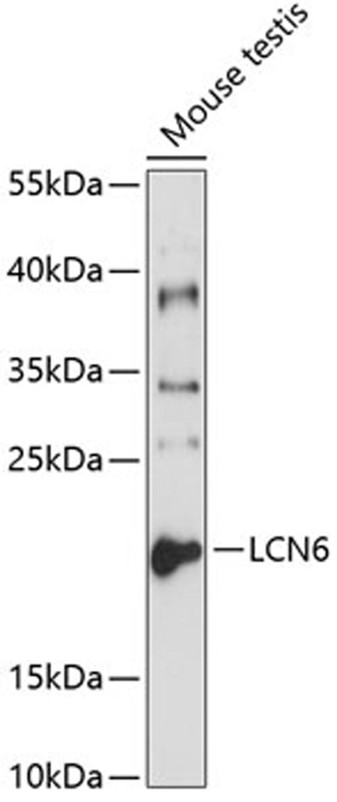 Western blot - LCN6 antibody (A1204)