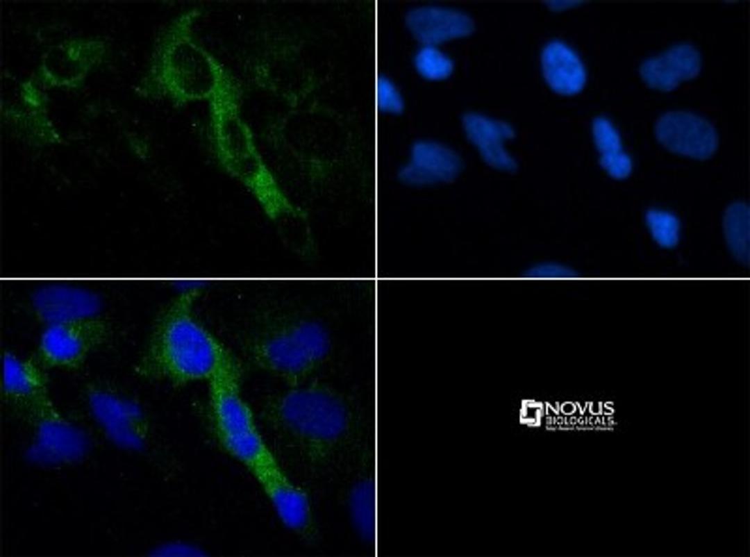 Immunocytochemistry/Immunofluorescence: 5HT4 Receptor Antibody [NBP1-78403] - ICC staining of 5HT4 receptor in HeLa cells with FITC (green). Nuclei were counterstained with DAPI (blue).