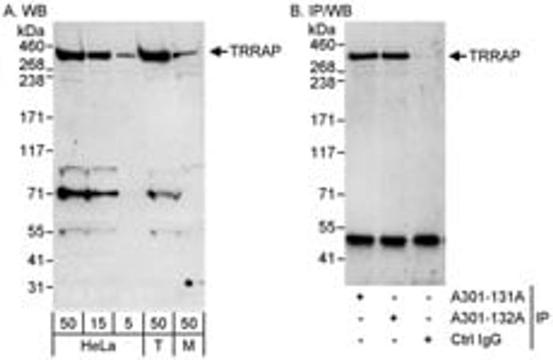 Detection of human and mouse TRRAP by western blot (h&m) and immunoprecipitation (h).