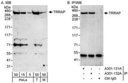 Detection of human and mouse TRRAP by western blot (h&m) and immunoprecipitation (h).