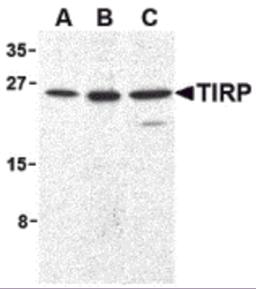 Western blot analysis of TIRP in human (A), mouse (B), and rat (C) kidney cell lysates with TIRP antibody (C2) at 1 &#956;g/mL.