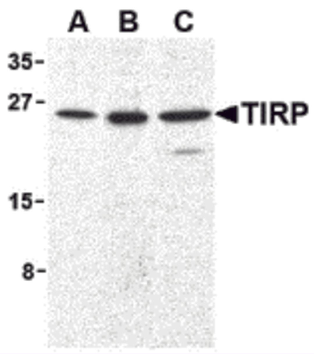 Western blot analysis of TIRP in human (A), mouse (B), and rat (C) kidney cell lysates with TIRP antibody (C2) at 1 μg/mL.