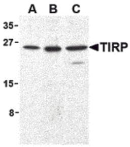 Western blot analysis of TIRP in human (A), mouse (B), and rat (C) kidney cell lysates with TIRP antibody (C2) at 1 μg/mL.