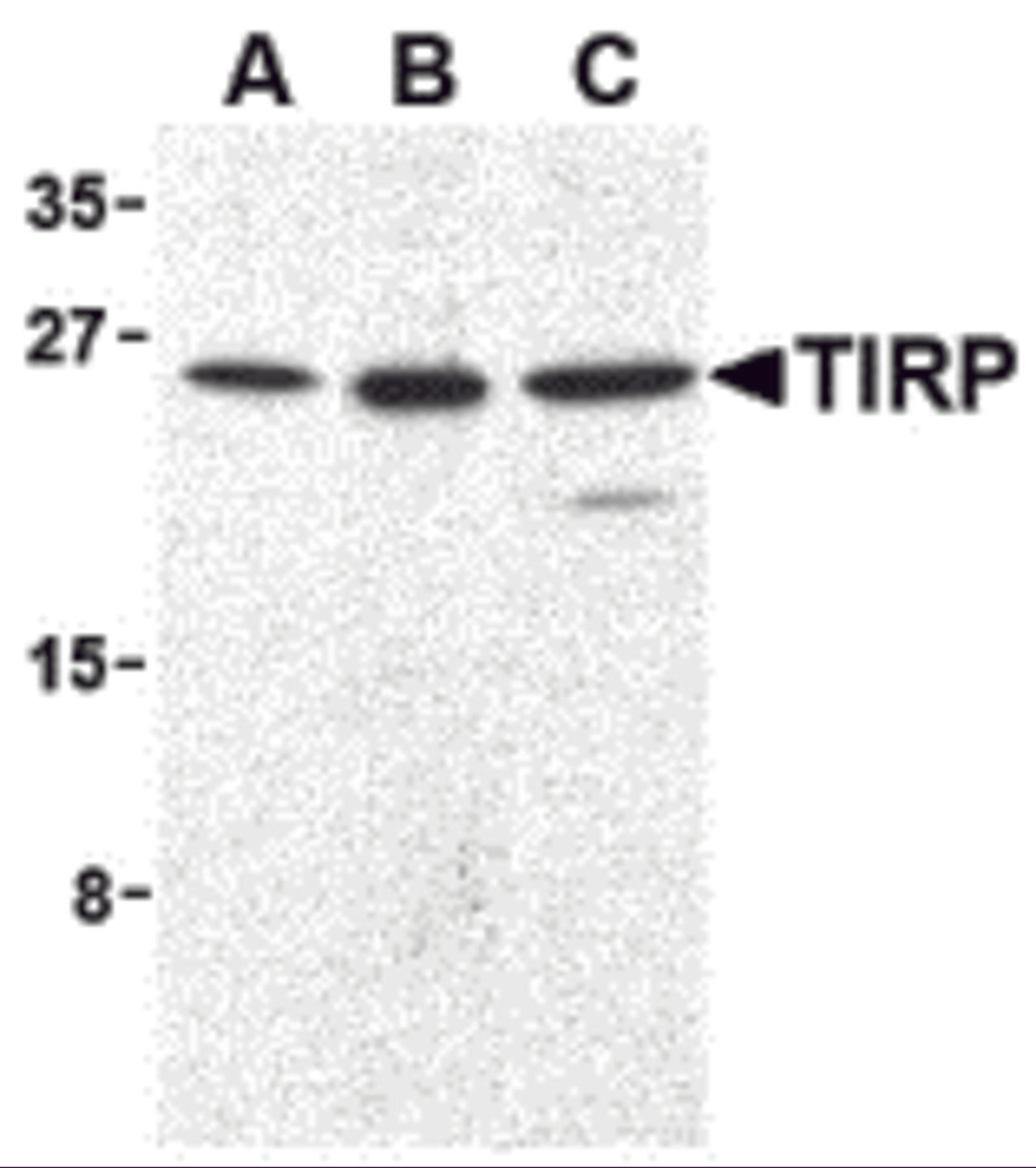 Western blot analysis of TIRP in human (A), mouse (B), and rat (C) kidney cell lysates with TIRP antibody (C2) at 1 μg/mL.