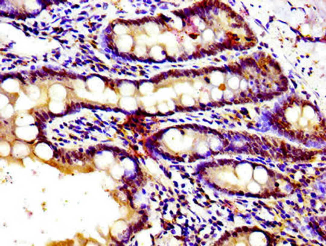 Immunohistochemistry of paraffin-embedded human small intestine tissue using CSB-PA009812LA01HU at dilution of 1:100