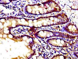Immunohistochemistry of paraffin-embedded human small intestine tissue using CSB-PA009812LA01HU at dilution of 1:100