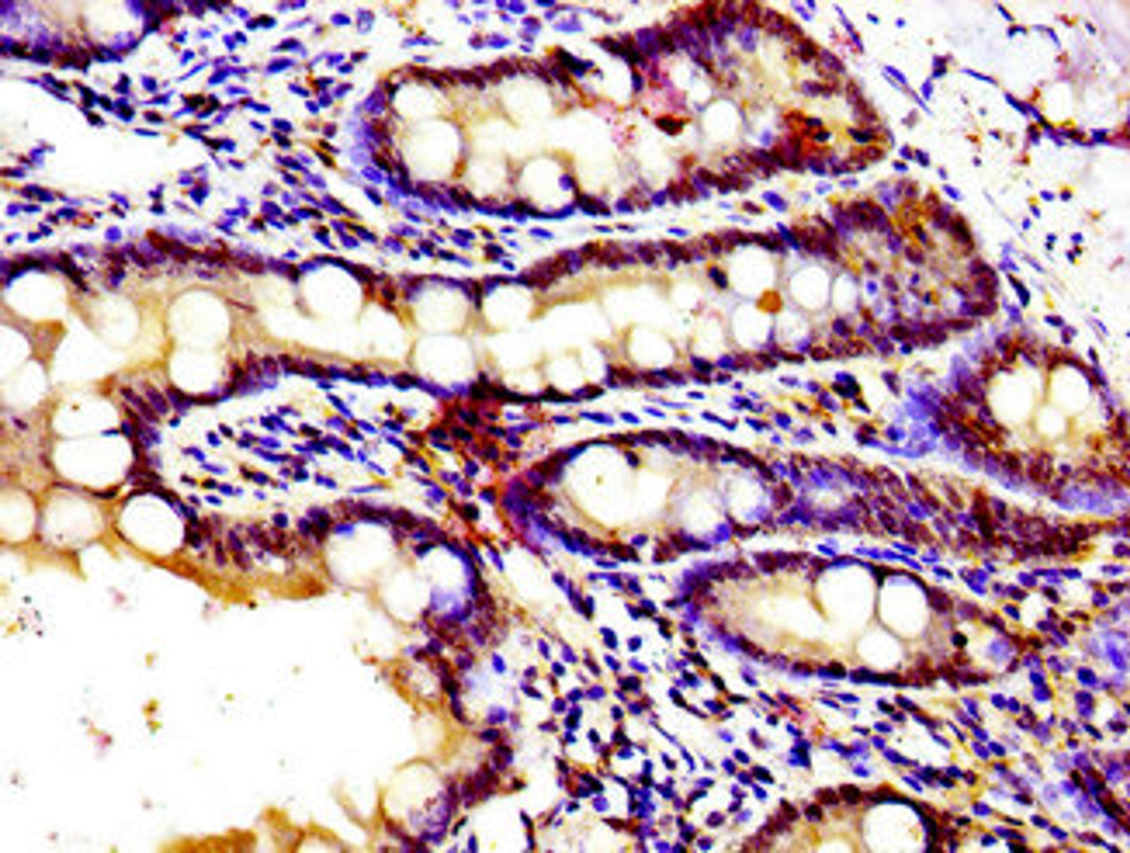 Immunohistochemistry of paraffin-embedded human small intestine tissue using CSB-PA009812LA01HU at dilution of 1:100
