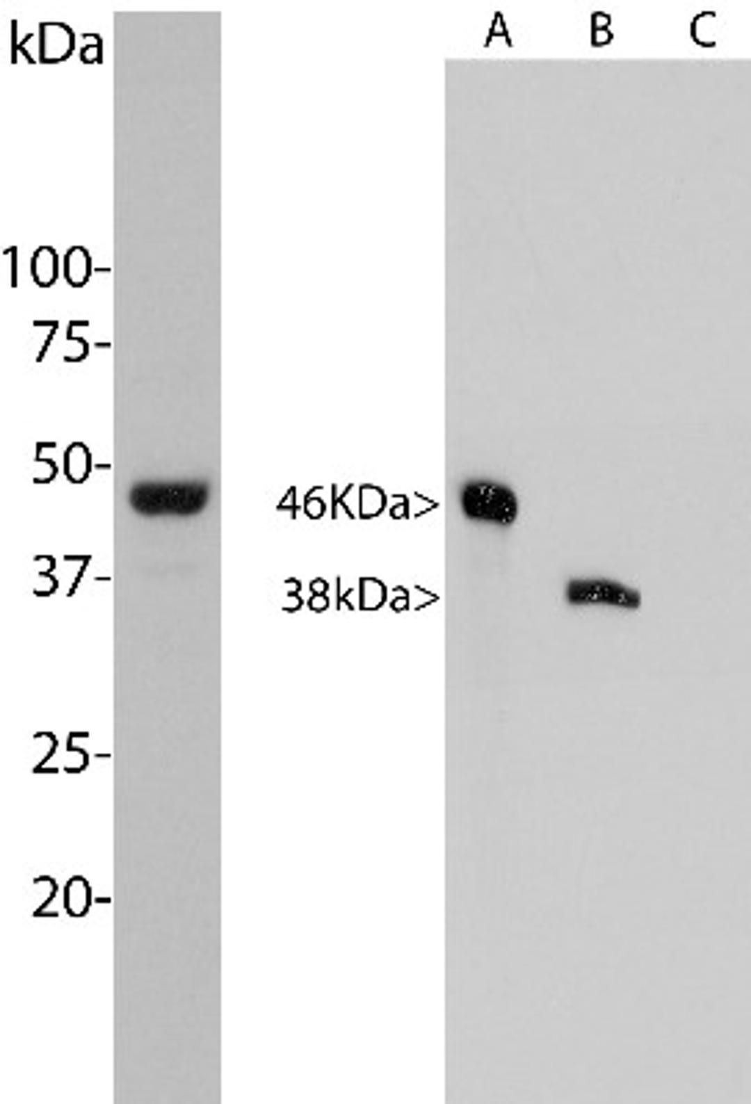 Western Blot: Aurora A/B Antibody (3H1) [NBP2-50043] - Left: Analysis of HeLa cells treated with 100ng/ml nocodazole for 18 h was probed with NBP2-50043. Nocodazole is a microtubule depolymerizing agent which induces cells to halt at the G2/M phase and also induces Aurora A expression. NBP2-50043 binds strongly to a band at about 46 kDa, which is Aurora A and also shows binding to a band at 38 kDa. Right: Blots of recombinant human Aurora A, B and C were probed with NBP2-50043, which binds to both Aurora A and B. We conclude that the 38 kDa band seen in the HeLa extract is Aurora B.